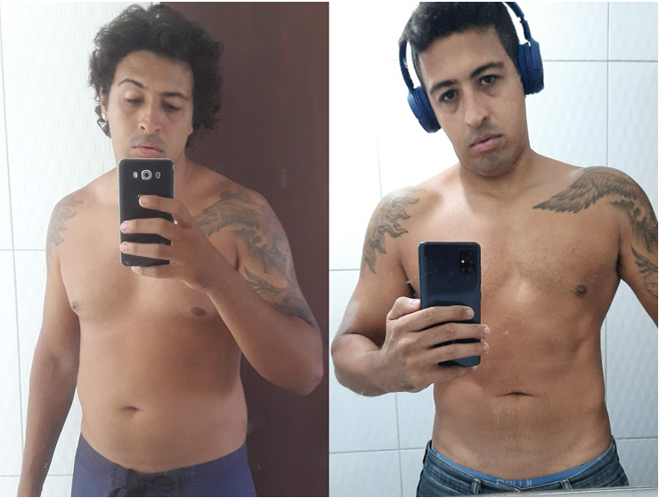 antes e depois  - 10 problemas de saúde causados pelo excesso de açúcar